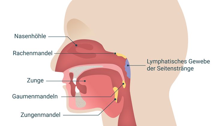 Schematische Darstellung der Rachenregion mit Beschriftung von Nasenhöhle, Mandeln und lymphatischem Gewebe.